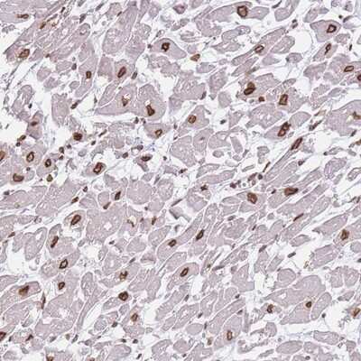 Immunohistochemistry-Paraffin: OR10AD1 Antibody [NBP2-13690]