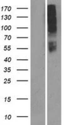 Western Blot: OR10AD1 Overexpression Lysate [NBP2-08932]