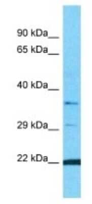 Western Blot: OR10G9 Antibody [NBP3-09849]