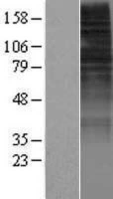 Western Blot: OR10H2 Overexpression Lysate [NBP2-07408]