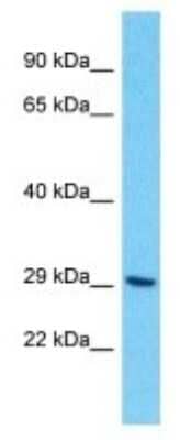 Western Blot: OR10H4 Antibody [NBP3-09852]