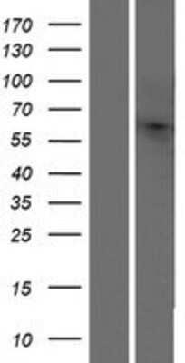 Western Blot: OR10H4 Overexpression Lysate [NBP2-08871]