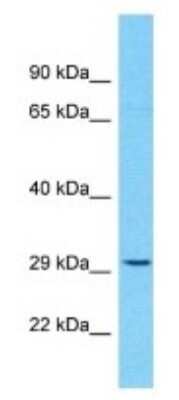 Western Blot: OR10H5 Antibody [NBP3-09853]