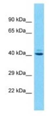 Western Blot: OR10J1 Antibody [NBP3-09854]