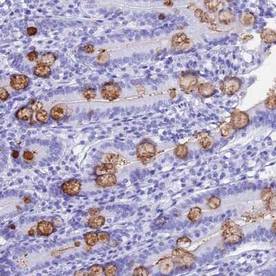 Immunohistochemistry-Paraffin: OR10J3 Antibody [NBP1-92222]