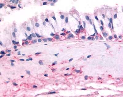 Immunohistochemistry-Paraffin: OR10J5 Antibody - BSA Free [NLS3159]