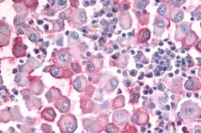 Immunohistochemistry-Paraffin: OR10J5 Antibody - BSA Free [NLS3159]