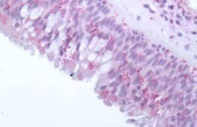 Immunohistochemistry-Paraffin: OR10J5 Antibody - BSA Free [NLS3159]