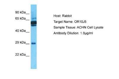 Western Blot: OR10J5 Antibody [NBP2-84198]