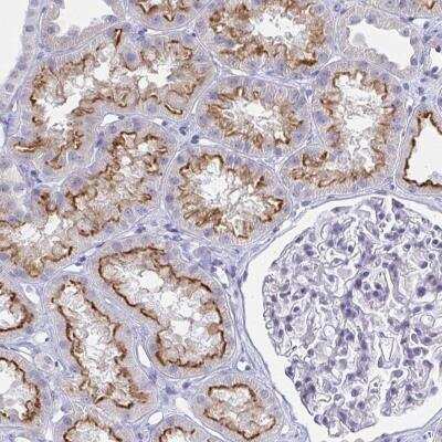 Immunohistochemistry-Paraffin: OR10K1 Antibody [NBP2-32427]