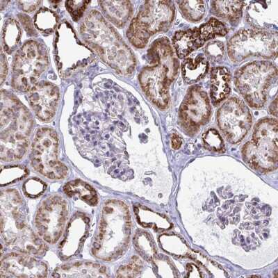 Immunohistochemistry: OR10R2 Antibody [NBP2-32494]