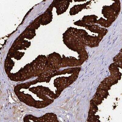 Immunohistochemistry-Paraffin: OR10R2 Antibody [NBP2-32541]