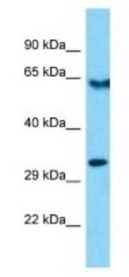 Western Blot: OR10R2 Antibody [NBP3-09858]