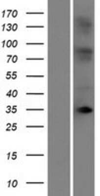 Western Blot: OR10T2 Overexpression Lysate [NBP2-08872]