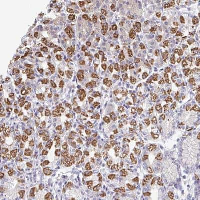 Immunohistochemistry-Paraffin: OR10V1 Antibody [NBP2-32514]