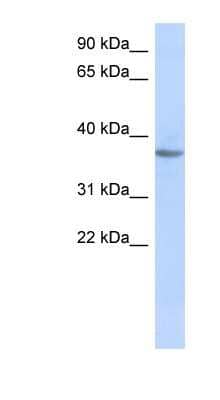 Western Blot: OR10X1 Antibody [NBP1-59629]