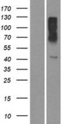 Western Blot: OR10X1 Overexpression Lysate [NBP2-08873]