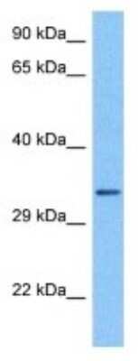 Western Blot: OR11A1 Antibody [NBP3-10003]