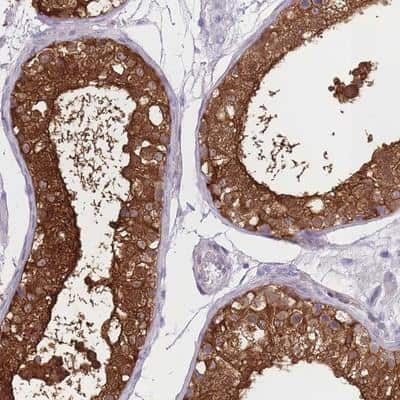 Immunohistochemistry-Paraffin: OR11H1 Antibody [NBP2-13693]