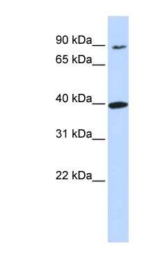 Western Blot: OR11H12 Antibody [NBP1-70664]