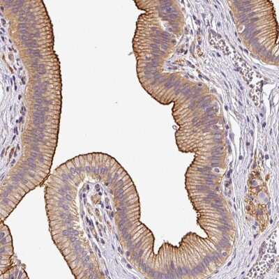 Immunohistochemistry: OR11H4 Antibody [NBP2-49062]