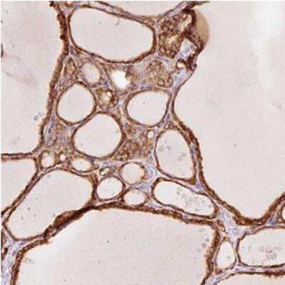 Immunohistochemistry: OR13C3 Antibody [NBP2-30763]