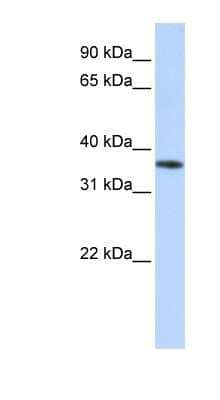 Western Blot: OR13C5 Antibody [NBP1-79975]