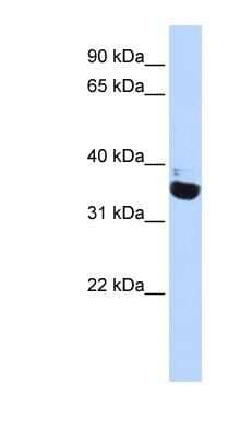 Western Blot: OR13C5 Antibody [NBP1-79994]