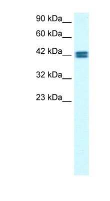 Western Blot: OR13C9 Antibody [NBP1-79985]