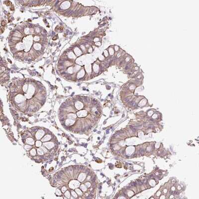 Immunohistochemistry: OR13D1 Antibody [NBP2-49203]