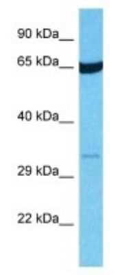 Western Blot: OR14I1 Antibody [NBP3-09860]