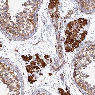 Immunohistochemistry-Paraffin: OR14J1 Antibody [NBP1-92223]