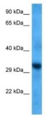 Western Blot: OR1A1 Antibody [NBP3-09990]