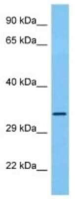 Western Blot: OR1A1 Antibody [NBP3-10274]