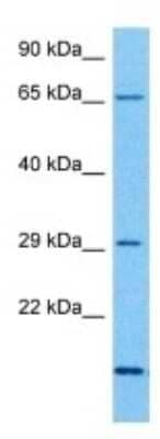 Western Blot: OR1A2 Antibody [NBP3-10002]