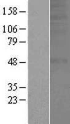 Western Blot: OR1A2 Overexpression Lysate [NBP2-07452]