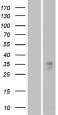 Western Blot: OR1B1 Overexpression Lysate [NBP2-08868]