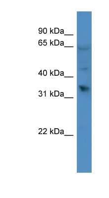 Western Blot: OR1D2 Antibody [NBP1-68971]