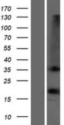 Western Blot: OR1D2 Overexpression Lysate [NBP2-08099]