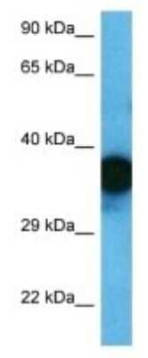 Western Blot: OR1F1 Antibody [NBP3-09758]