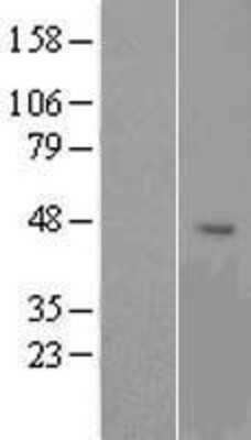 Western Blot: OR1G1 Overexpression Lysate [NBP2-07984]