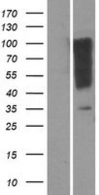 Western Blot: OR1I1 Overexpression Lysate [NBP2-08897]