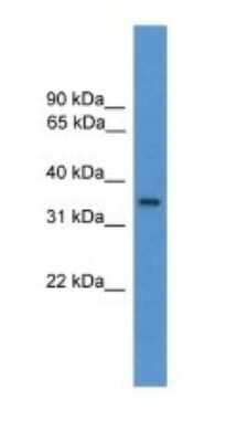 Western Blot: OR1J1 Antibody [NBP1-69092]