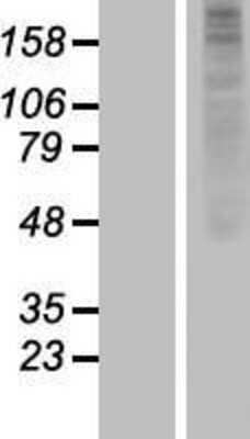 Western Blot: OR1J2 Overexpression Lysate [NBP2-05807]