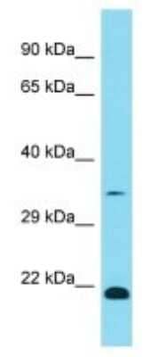 Western Blot: OR1K1 Antibody [NBP3-09759]