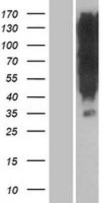 Western Blot: OR1K1 Overexpression Lysate [NBP2-05753]