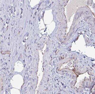 Immunohistochemistry-Paraffin: OR1L3 Antibody [NBP2-31731]