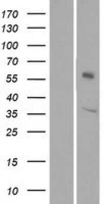 Western Blot: OR1L6 Overexpression Lysate [NBP2-08869]