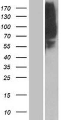 Western Blot: OR1L8 Overexpression Lysate [NBP2-08870]