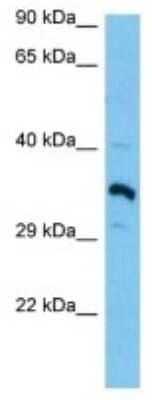 Western Blot: OR1M1 Antibody [NBP3-10247]